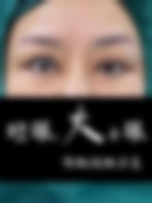 韩国Topclass整形外科真人口碑评价怎么样？