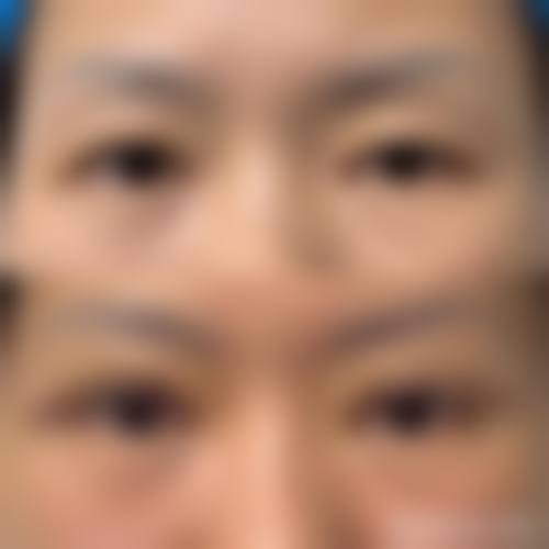 李东翰医生技术优势