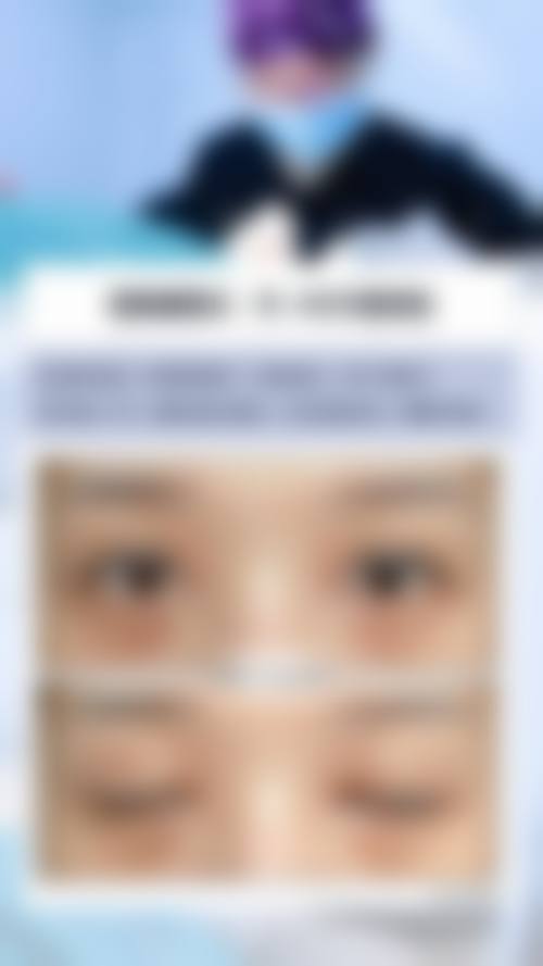 北京叶美人医疗美容整形医院收费价格表/收费标准