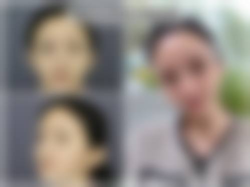 全鎔焄医生口碑评价及真人实例