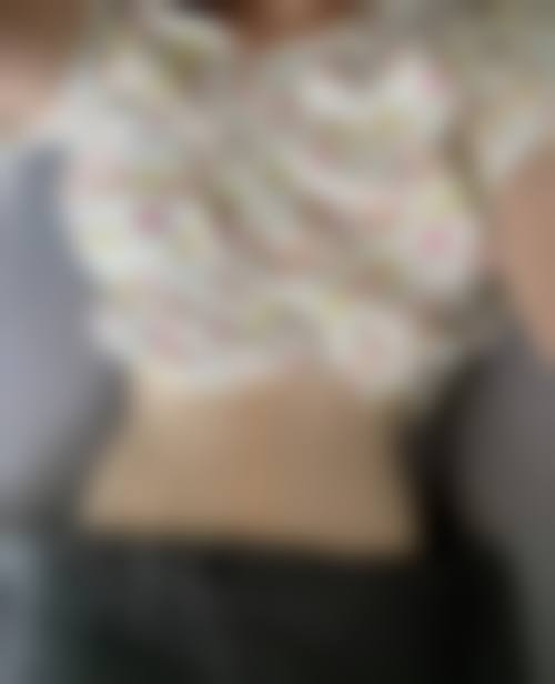 九院吸脂技术优势