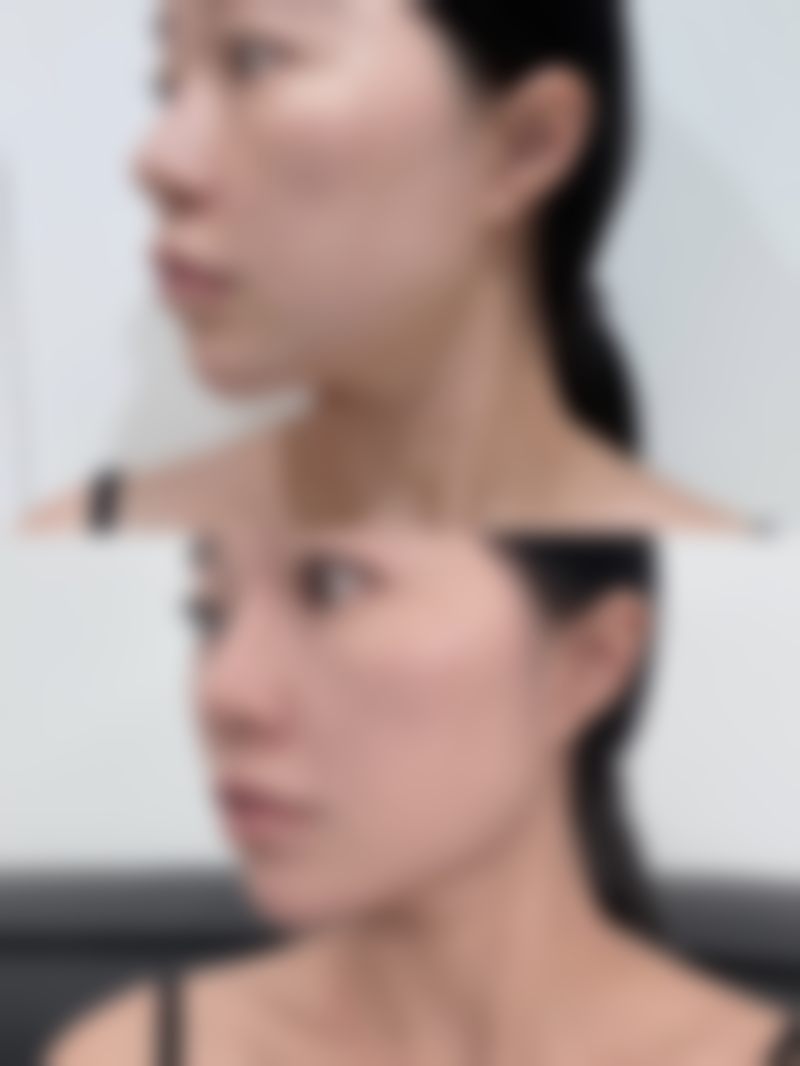 术后睡姿调整小贴士