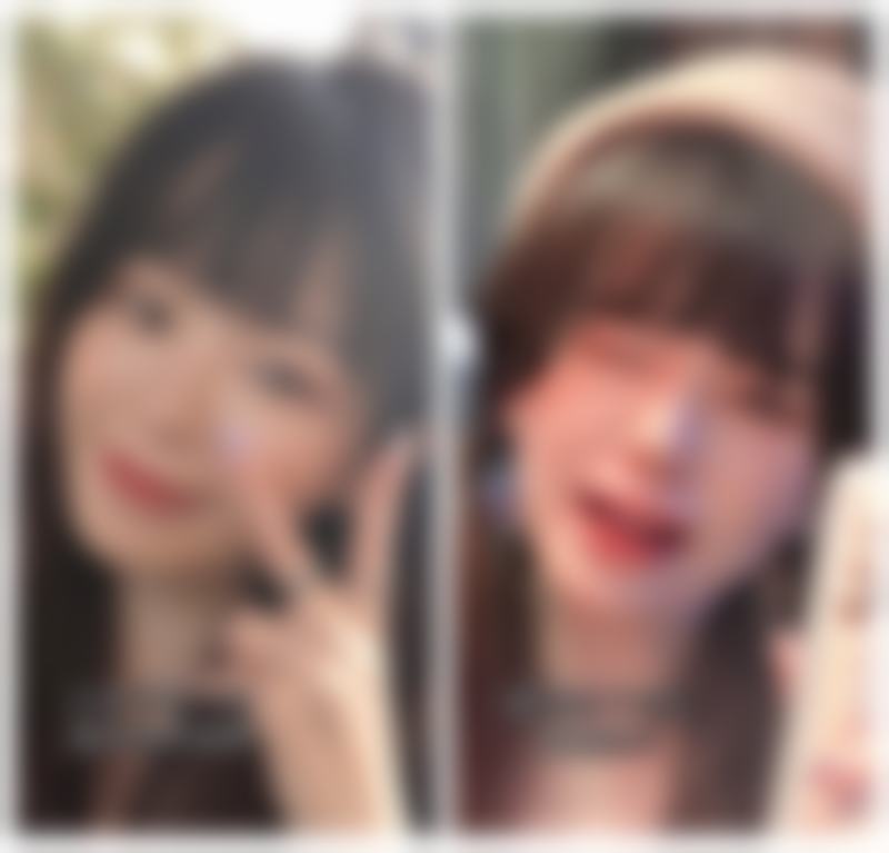 去眼袋激光有效果吗？对轻中度眼袋效果显著，选正规机构微创无痕还能淡细纹