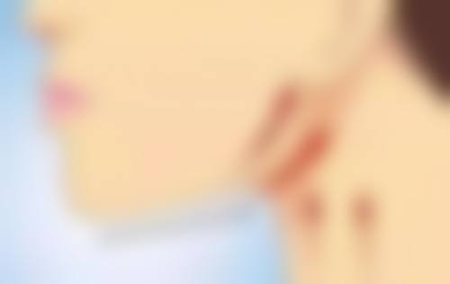 双眼皮后冰敷多久一次？三甲医师建议：术后48小时内每日3-5次，每次15-20分钟