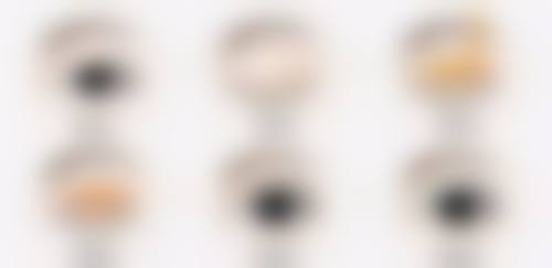 怎样可以快速除皱？试试无创口注射，正规医美机构操作后立竿见影