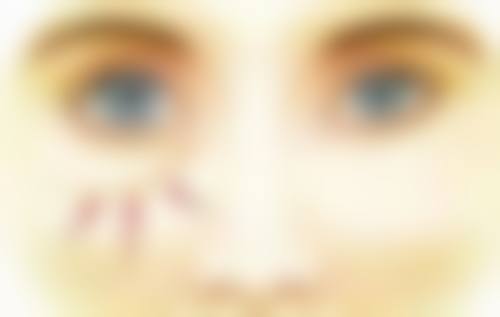 单眼皮为什么没有双眼皮好看？多因眼小无神欠灵动，选对医生可打造自然妈生眼