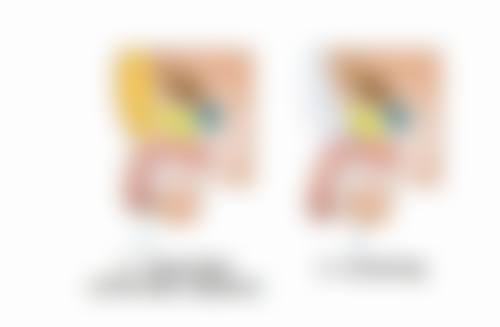 价格考量：提眉与双眼皮手术的费用差异