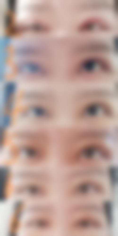 李东翰医生技术优势