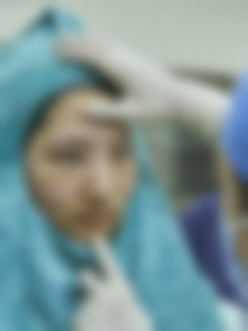 李东翰医生口碑评价及真人实例