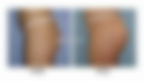 秦皇岛市第一医院医学整形美容中 心特色项目及技术优势