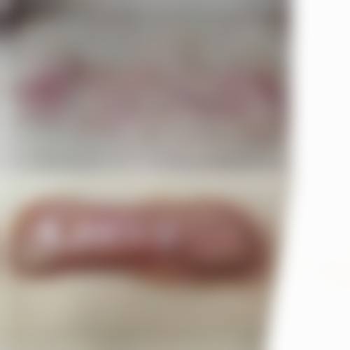 疤痕修复价格透明