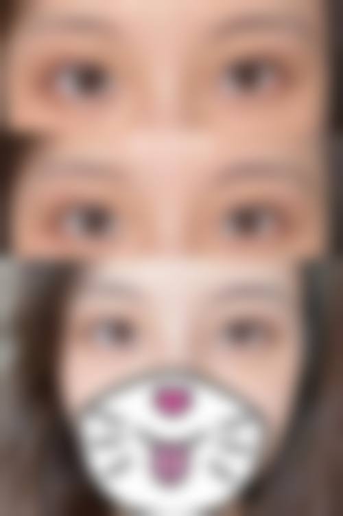 贵阳市第三人民医院整形美容科收费价格表/收费标准