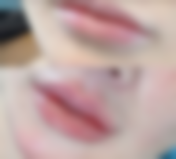 不同医生建议的冰敷频率和时长