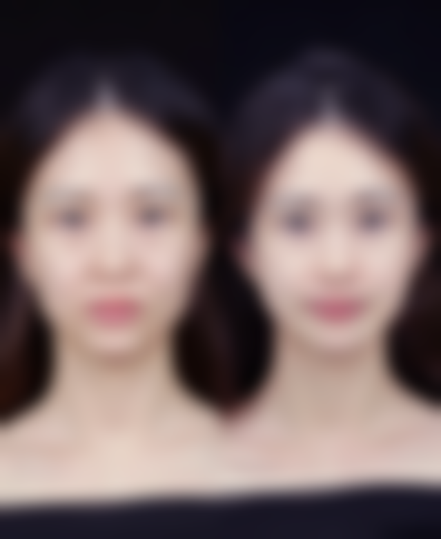 与其他放疗技术的费用对比