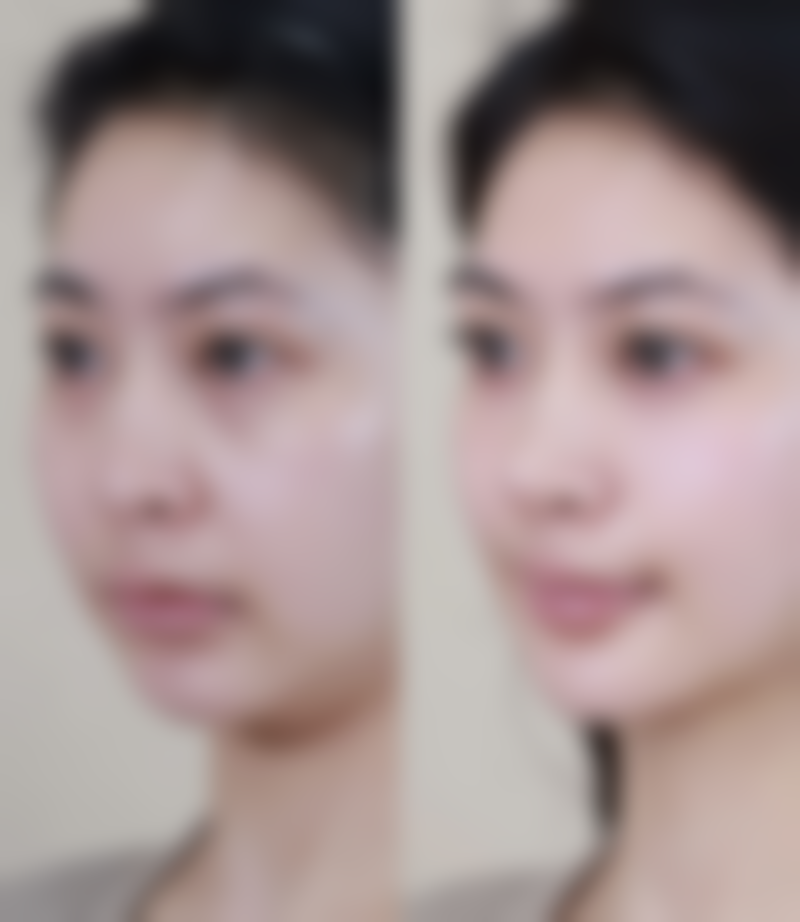 碰水洗脸的注意事项