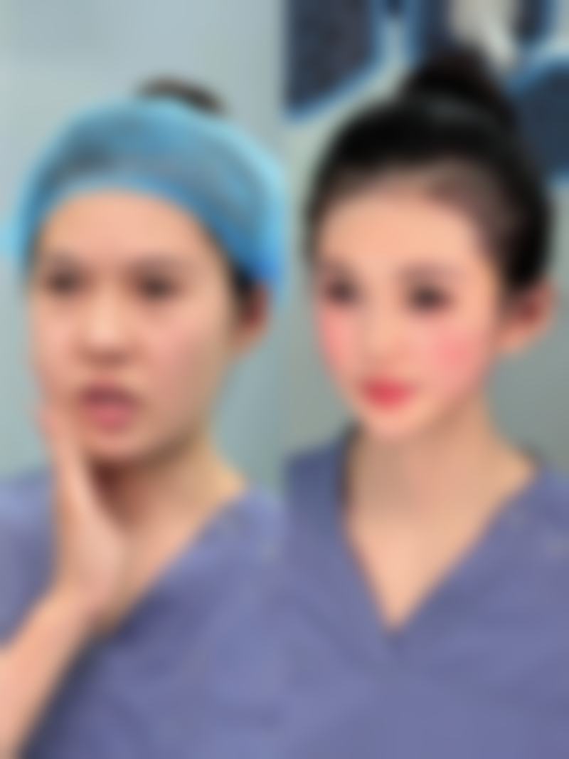 面部缝合疤痕怎么去除？找九院出身医生，用药膏/激光花费5000-20000元起