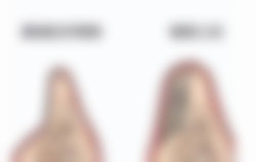 美学与风险提示:谨慎选择,守护眼部美丽与健康