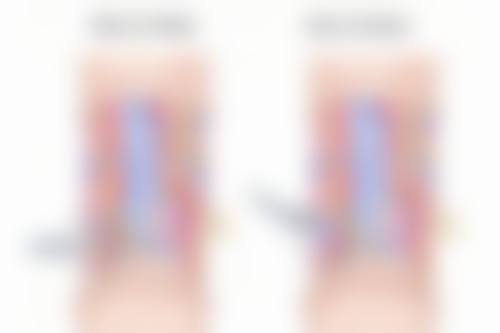 滴眼液使用的注意事项