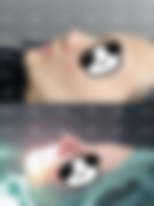 郑民宇医生技术优势