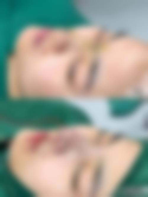 李东翰医生擅长项目