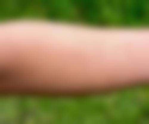 雷丽娥医生口碑评价及真人实例