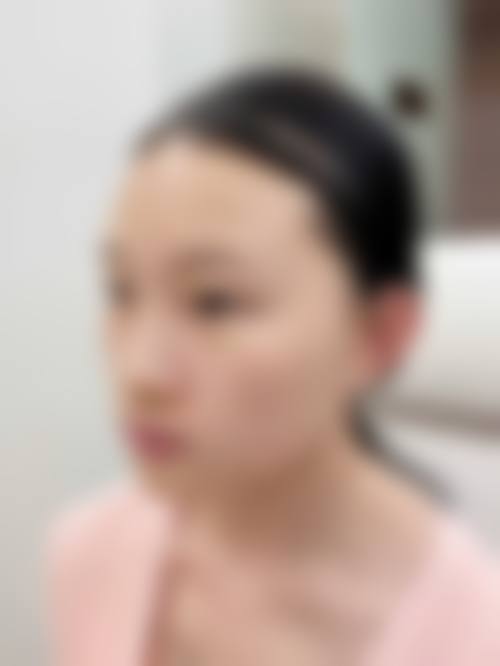 佛山汇莹源整形医院详细的预约挂号方式及流程