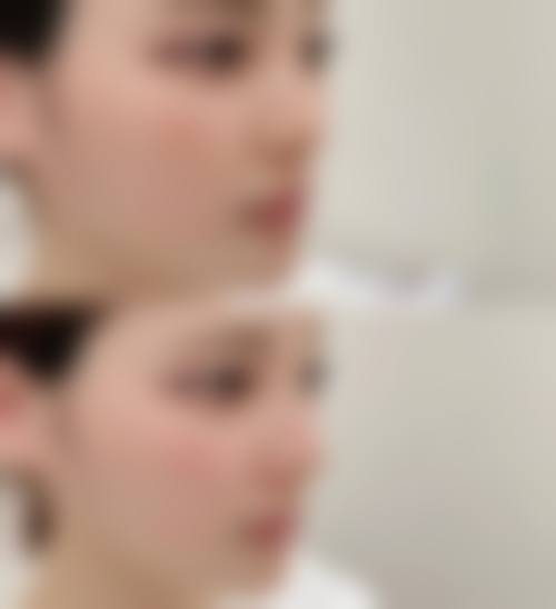 朴鲜俊医生价格表