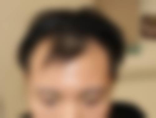 沈阳伍柒笙泽植发医院详细的预约挂号方式及流程