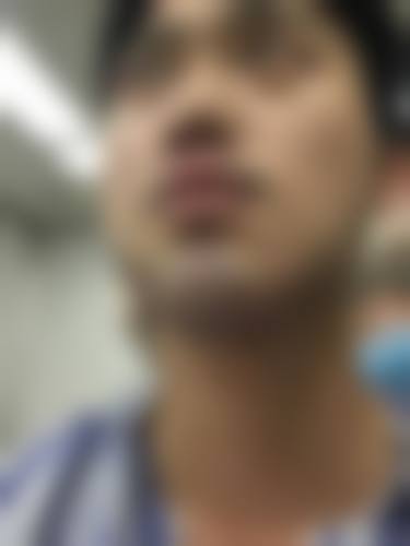 沈阳伍柒笙泽植发医院真人口碑评价怎么样?