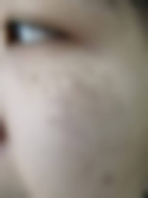 沈阳杏林医院做祛斑怎么样？定制方案+专家团队，祛斑效果好，患者口碑佳！ 