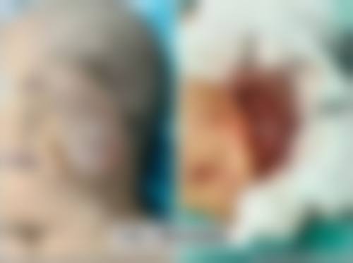 浙江大学医学校附属邵逸夫医院整形外科收费价格表/收费标准