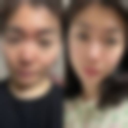 朴鲜俊医生技术优势