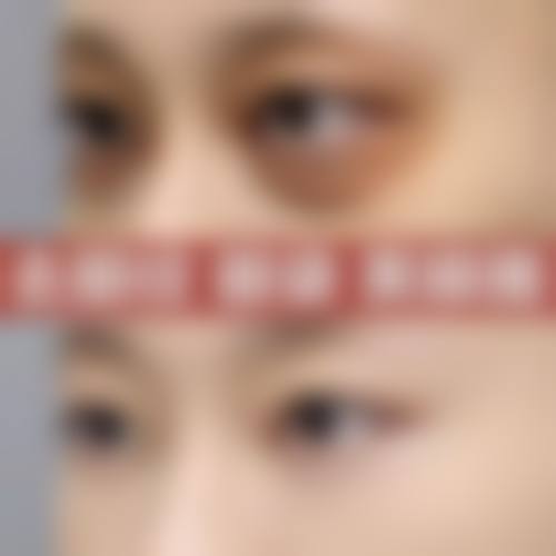 长春易相医疗美容门诊部真人口碑评价怎么样？