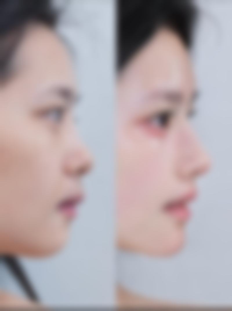 苏州美博医疗美容诊所收费价格表/收费标准