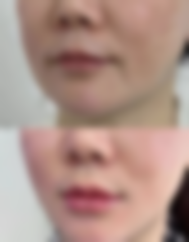 不同材料的价格对比与选择建议