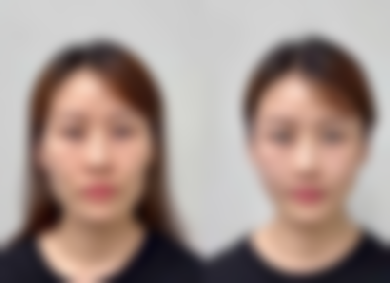 云南昆明艺博口腔特色项目及技术优势