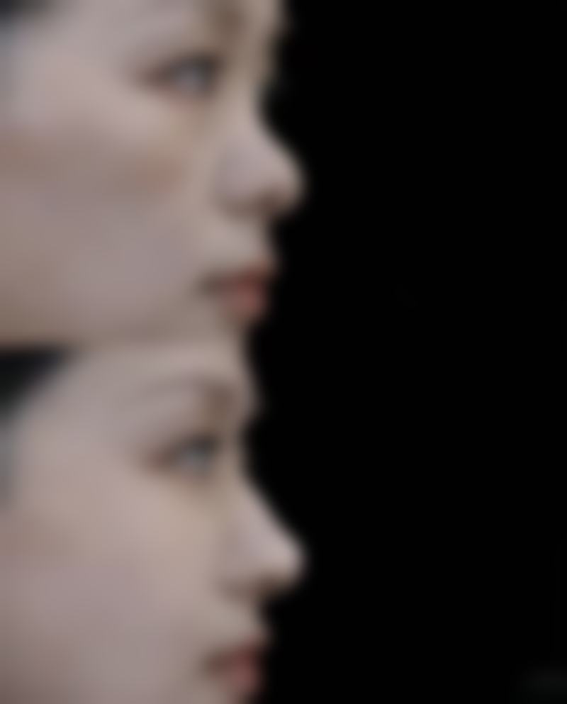 术后护理与注意事项助力理想修复