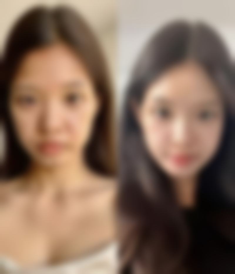 联合治疗：多种方法协同作战的强大力量