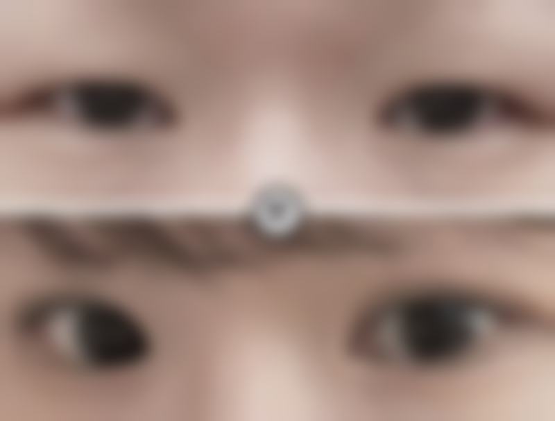 药物治疗：涂抹与注射的双管齐下