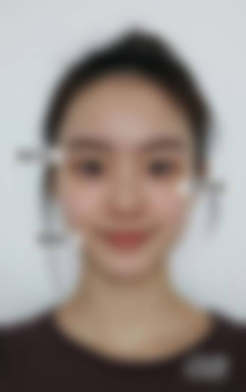 手术项目优势多