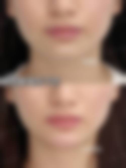 成都玉嫱医疗美容诊所真人口碑评价怎么样？