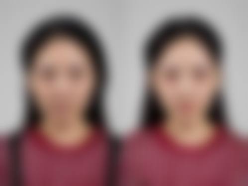 小仓美肌诊所真人口碑评价怎么样？