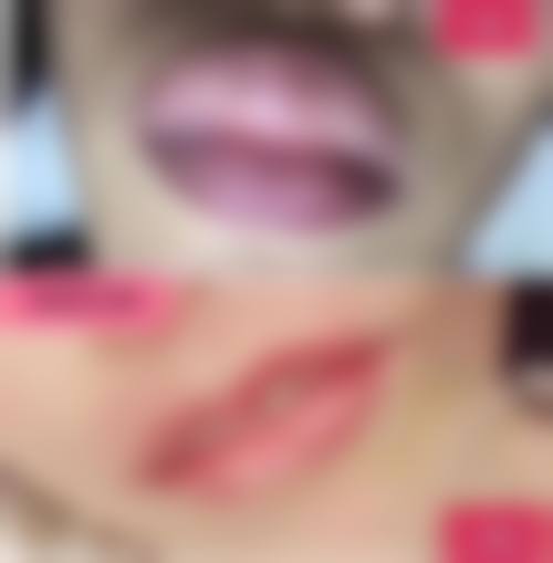 心脏状况不同,眼袋手术选择大不同