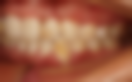 石家庄蓝山医疗美容医院(口腔科)特色项目及技术优势