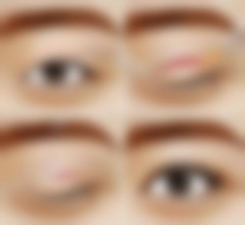 北京漾之颜整形医院真人口碑评价怎么样?