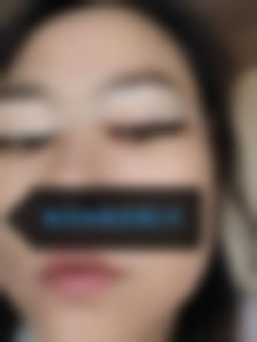 河北友爱医院整形美容科真人口碑评价怎么样?