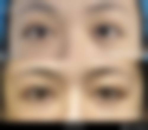 永州美辰医疗美容门诊部真人口碑评价怎么样？