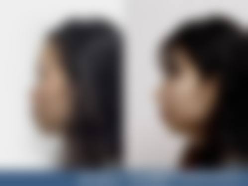 衢州伊美医疗美容门诊部真人口碑评价怎么样?