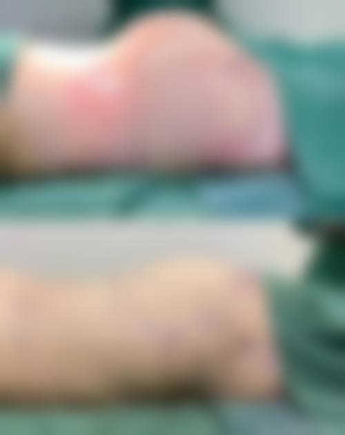 衢州伊美医疗美容门诊部特色项目及技术优势