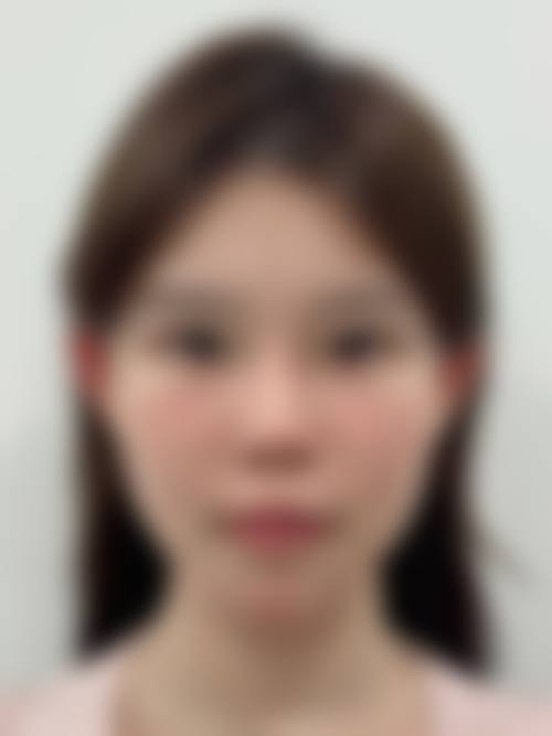 山东临沂媄媄整形医院收费价格表/收费标准